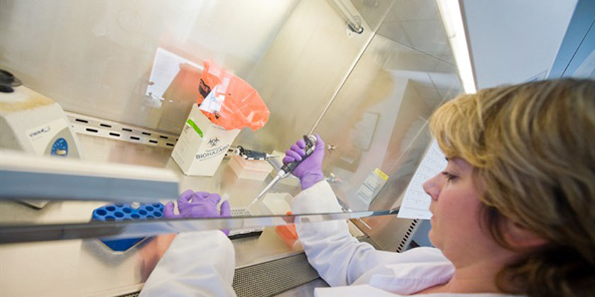 HBV DNA Real Time PCR